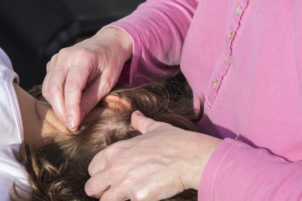 How to Get Rid of Head Lice - Treatment and Remedies