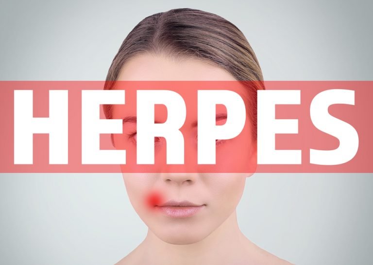 one minute cure herpes