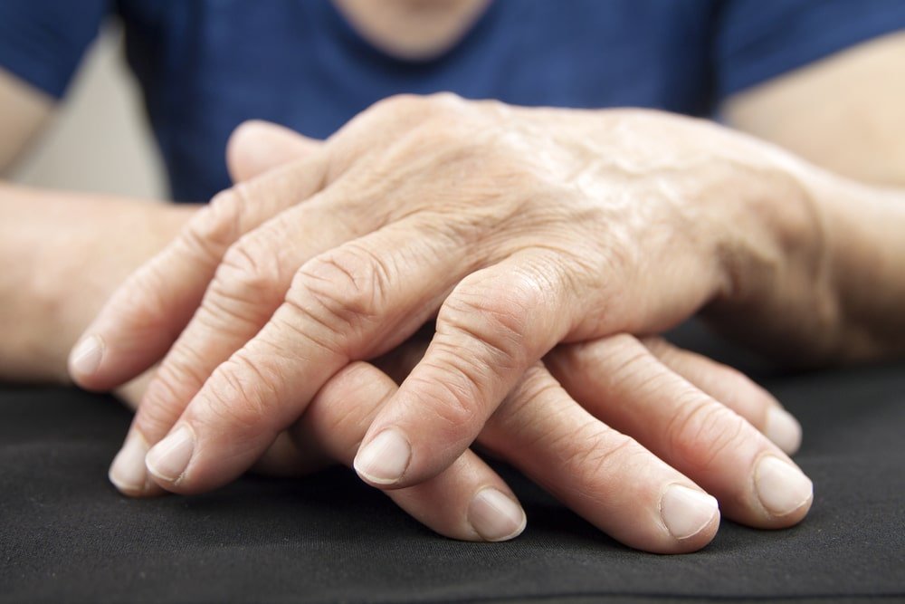 11 Home Remedies For Rheumatoid Arthritis