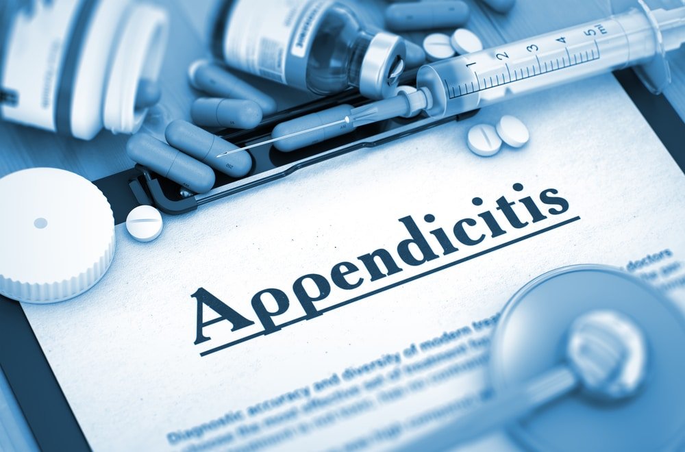Appendicitis: Causes, Symptoms, and Treatment
