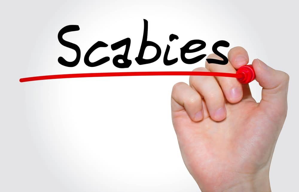 9 Natural Treatments for Scabies