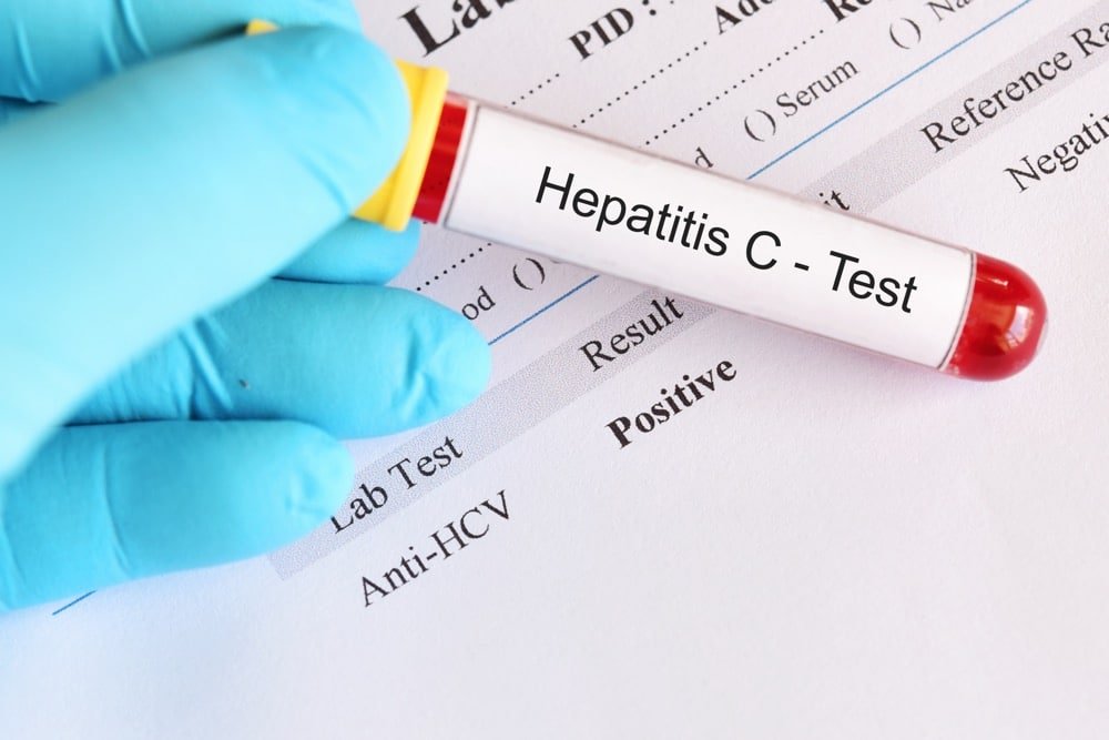 Symptoms and Warning Signs of Hepatitis C