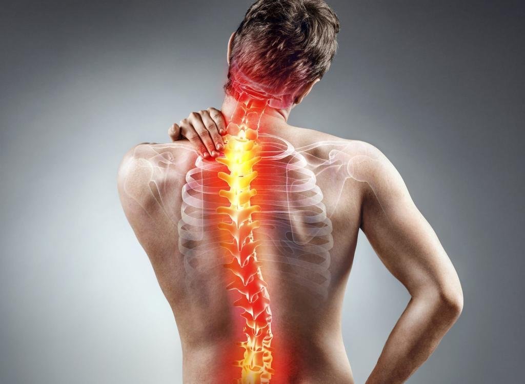 Scoliosis: Causes, Symptoms, and Treatment