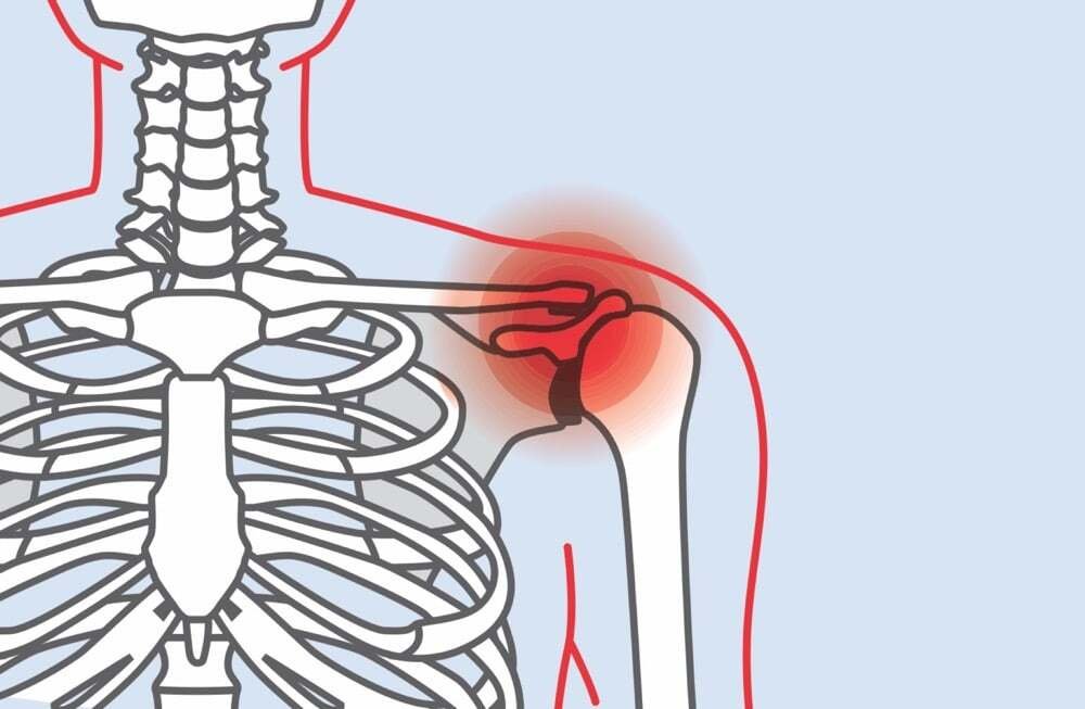 Causes of Shoulder Pain