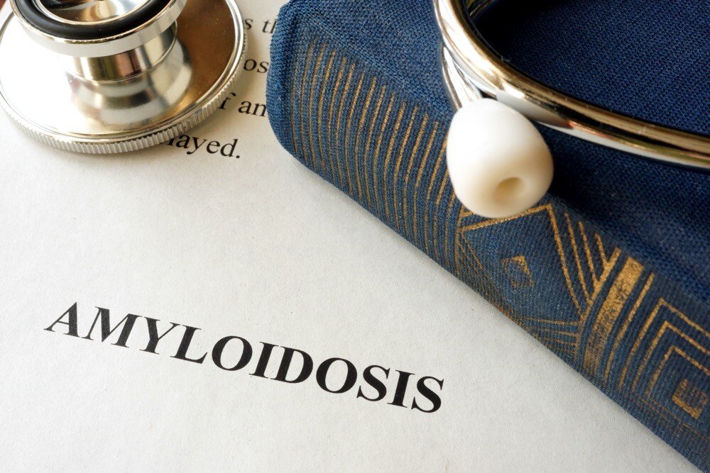 Amyloidosis: Symptoms, Diagnosis, and Treatment